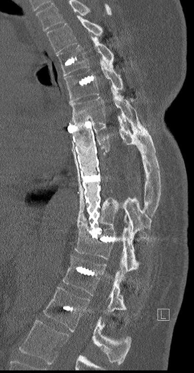 Slide 47